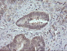 MAP2K3 Antibody in Immunohistochemistry (Paraffin) (IHC (P))