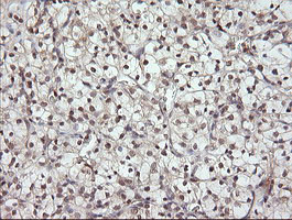 MAP2K3 Antibody in Immunohistochemistry (Paraffin) (IHC (P))