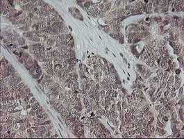 MAP2K3 Antibody in Immunohistochemistry (Paraffin) (IHC (P))