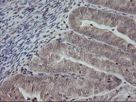 MAP2K3 Antibody in Immunohistochemistry (Paraffin) (IHC (P))