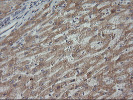 MAP2K3 Antibody in Immunohistochemistry (Paraffin) (IHC (P))