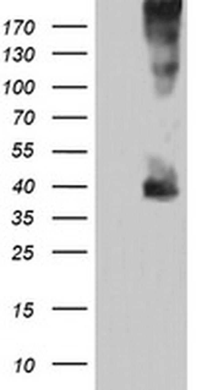 MAP2K3 Antibody in Western Blot (WB)