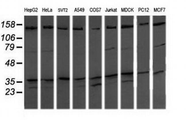 MAP2K3 Antibody in Western Blot (WB)