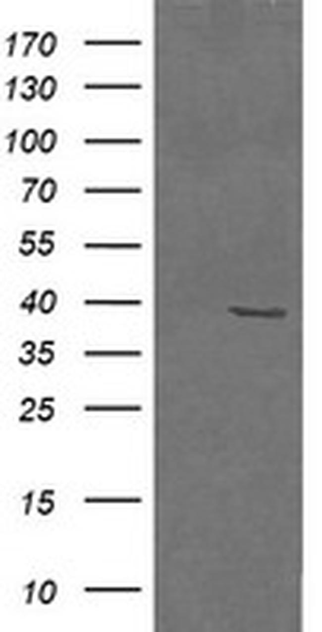 MAP2K3 Antibody in Western Blot (WB)