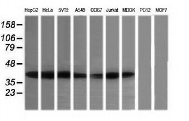 MAP2K3 Antibody in Western Blot (WB)