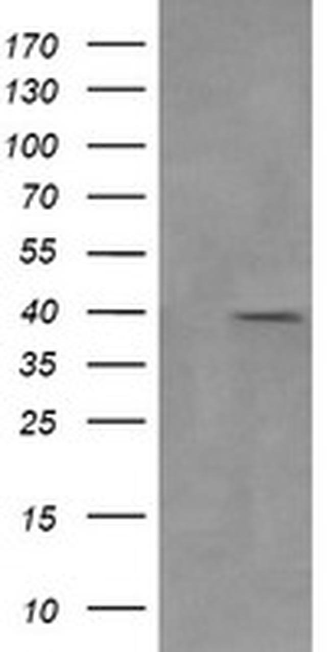 MAP2K3 Antibody in Western Blot (WB)