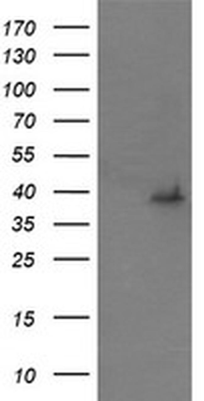 MAP2K3 Antibody in Western Blot (WB)