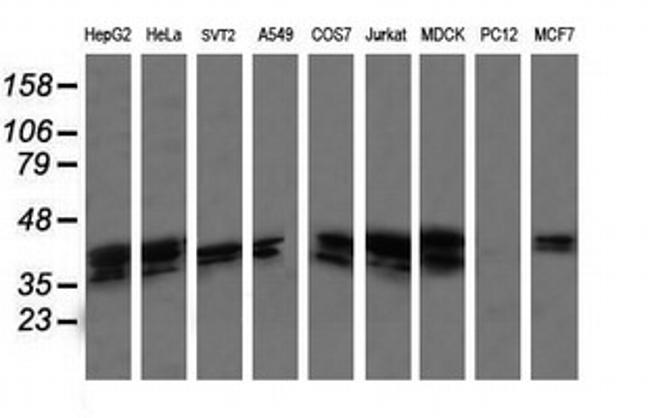 MAP2K3 Antibody in Western Blot (WB)