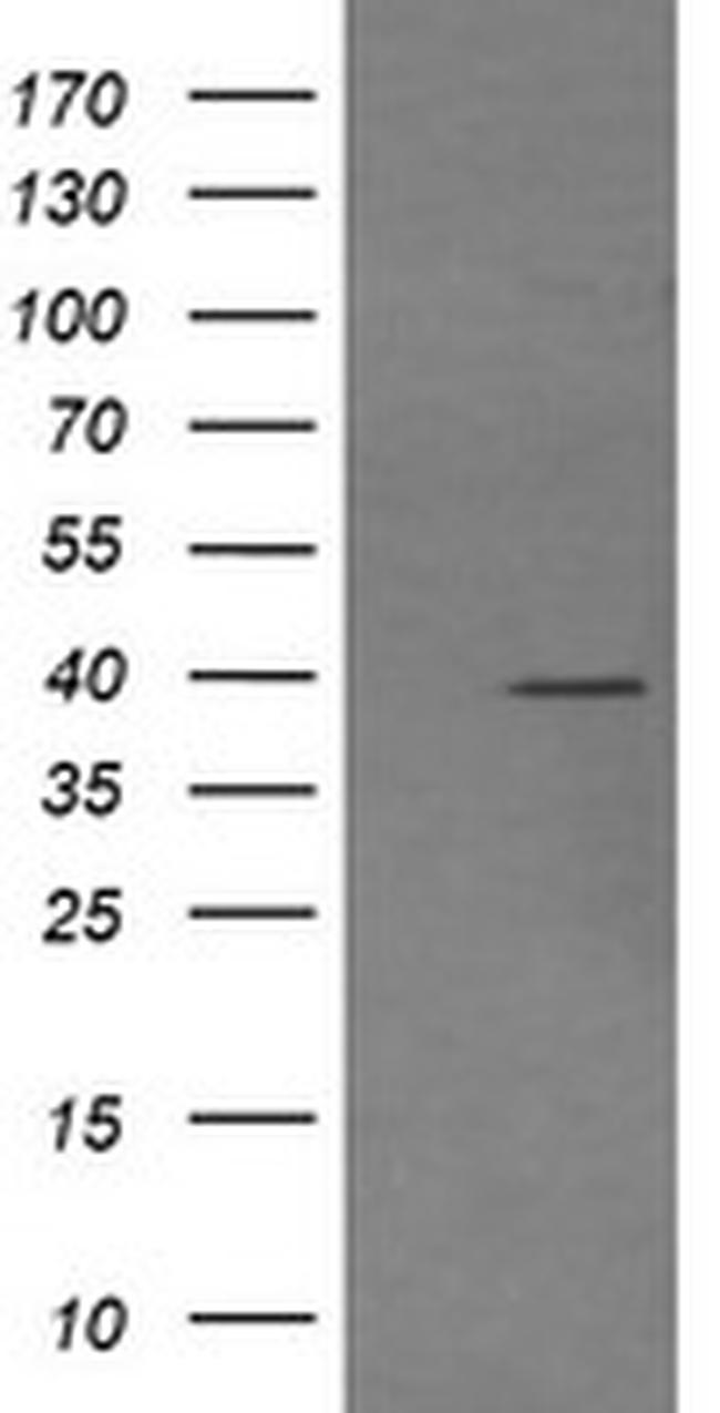 MAP2K3 Antibody in Western Blot (WB)