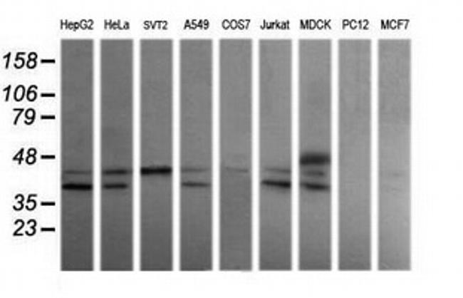 MAP2K3 Antibody in Western Blot (WB)