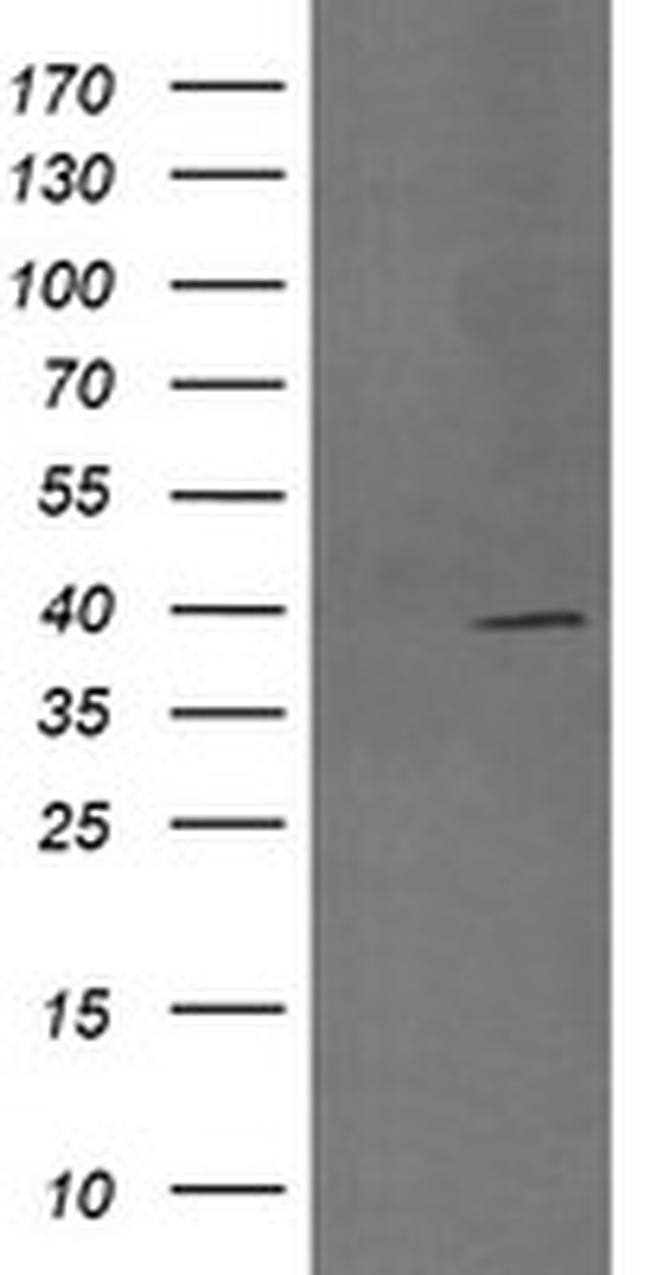 MAP2K3 Antibody in Western Blot (WB)