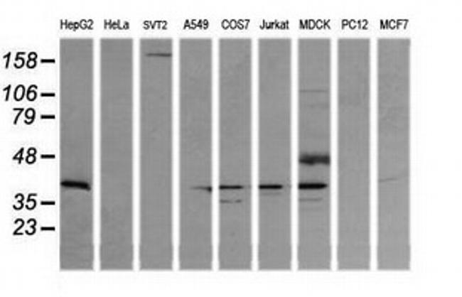 MAP2K3 Antibody in Western Blot (WB)