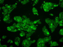 MAP2K4 Antibody in Immunocytochemistry (ICC/IF)