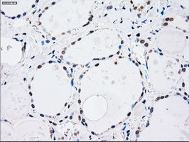 MAP2K4 Antibody in Immunohistochemistry (Paraffin) (IHC (P))