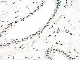 MAP2K4 Antibody in Immunohistochemistry (Paraffin) (IHC (P))