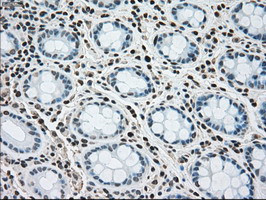 MAP2K4 Antibody in Immunohistochemistry (Paraffin) (IHC (P))