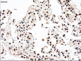 MAP2K4 Antibody in Immunohistochemistry (Paraffin) (IHC (P))