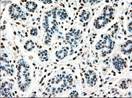 MAP2K4 Antibody in Immunohistochemistry (Paraffin) (IHC (P))