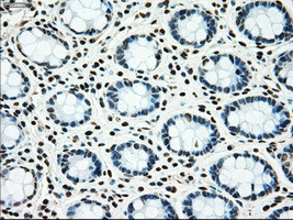 MAP2K4 Antibody in Immunohistochemistry (Paraffin) (IHC (P))