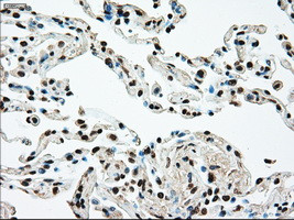 MAP2K4 Antibody in Immunohistochemistry (Paraffin) (IHC (P))