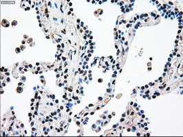 MAP2K4 Antibody in Immunohistochemistry (Paraffin) (IHC (P))