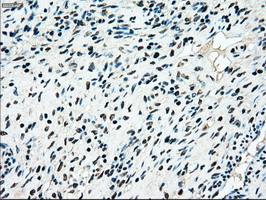 MAP2K4 Antibody in Immunohistochemistry (Paraffin) (IHC (P))