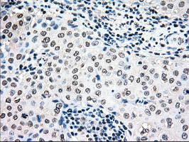 MAP2K4 Antibody in Immunohistochemistry (Paraffin) (IHC (P))