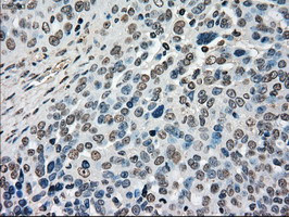 MAP2K4 Antibody in Immunohistochemistry (Paraffin) (IHC (P))