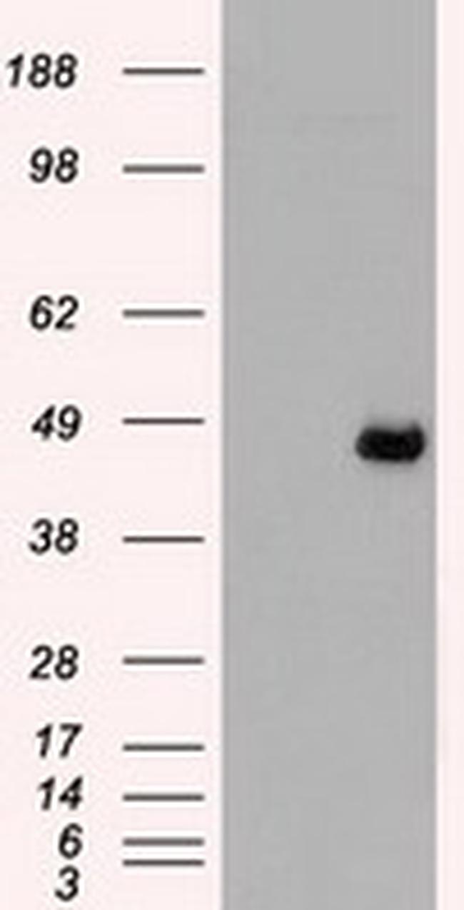 MAP2K4 Antibody in Western Blot (WB)