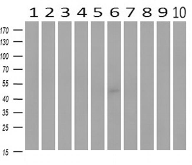 MAP2K4 Antibody in Western Blot (WB)