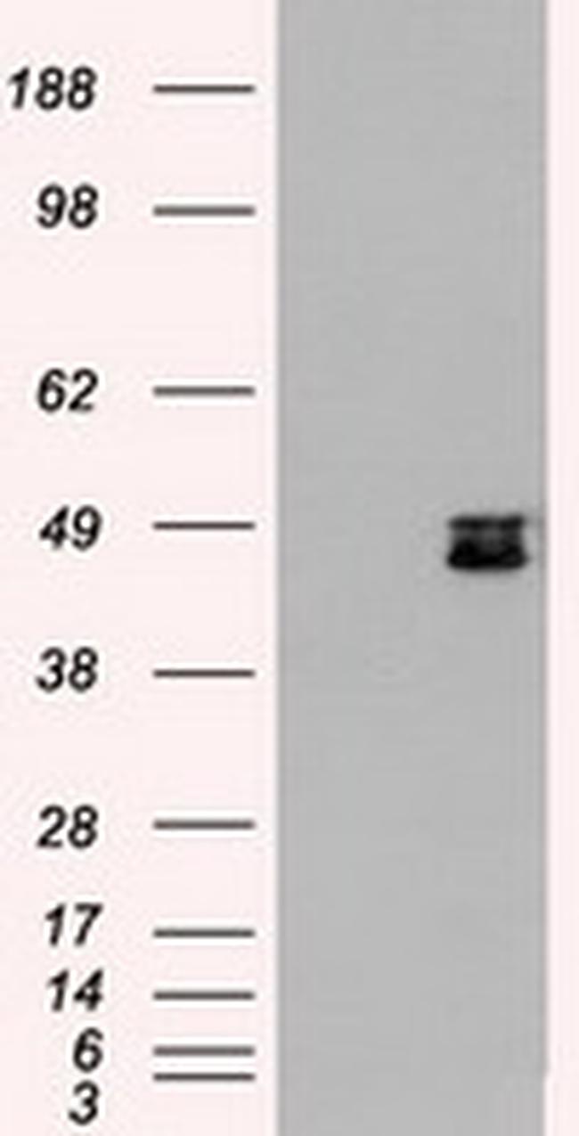 MAP2K4 Antibody in Western Blot (WB)