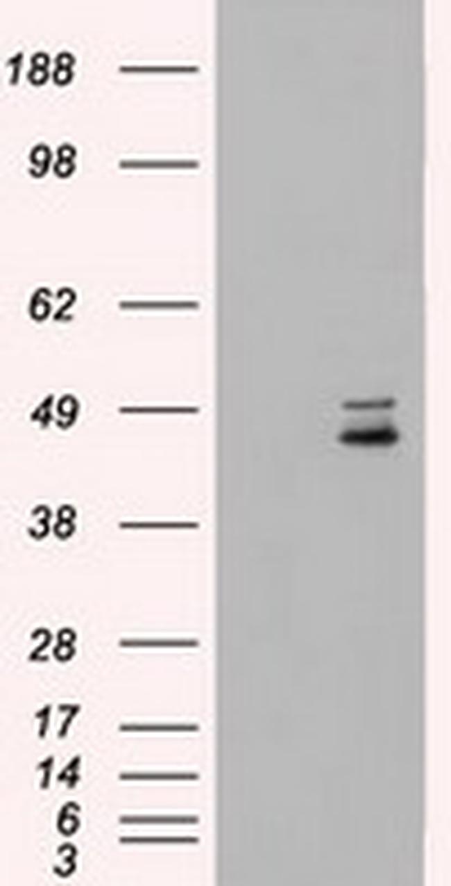 MAP2K4 Antibody in Western Blot (WB)