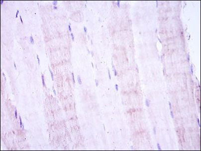 MAP2K4 Antibody in Immunohistochemistry (Paraffin) (IHC (P))