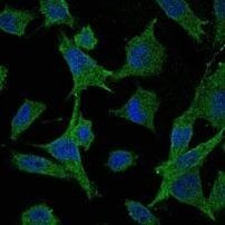 MEK6 Antibody in Immunocytochemistry (ICC/IF)