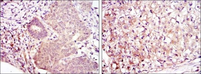 MEK6 Antibody in Immunohistochemistry (Paraffin) (IHC (P))