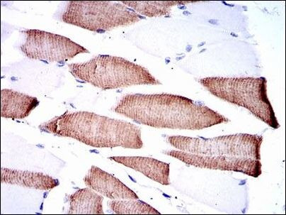 MEK7 Antibody in Immunohistochemistry (Paraffin) (IHC (P))