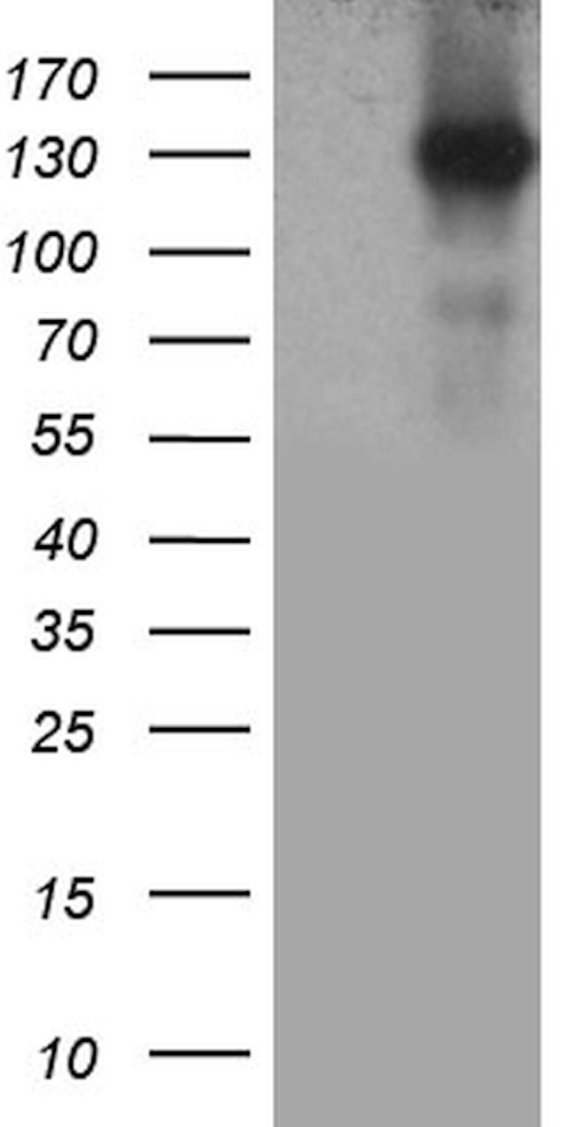 MAP3K13 Antibody in Western Blot (WB)