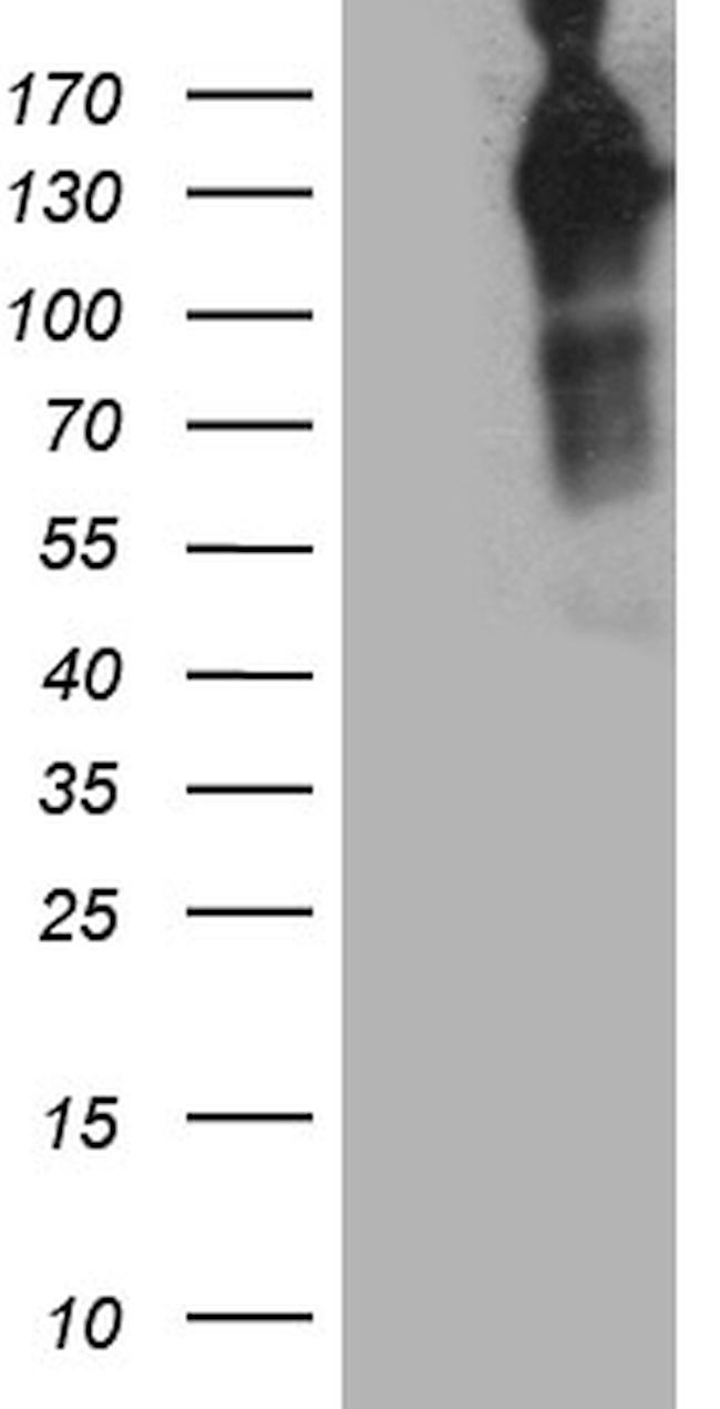 MAP3K13 Antibody in Western Blot (WB)