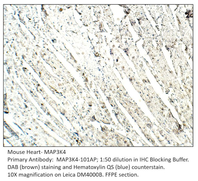 MAP3K4 Antibody in Immunohistochemistry (IHC)