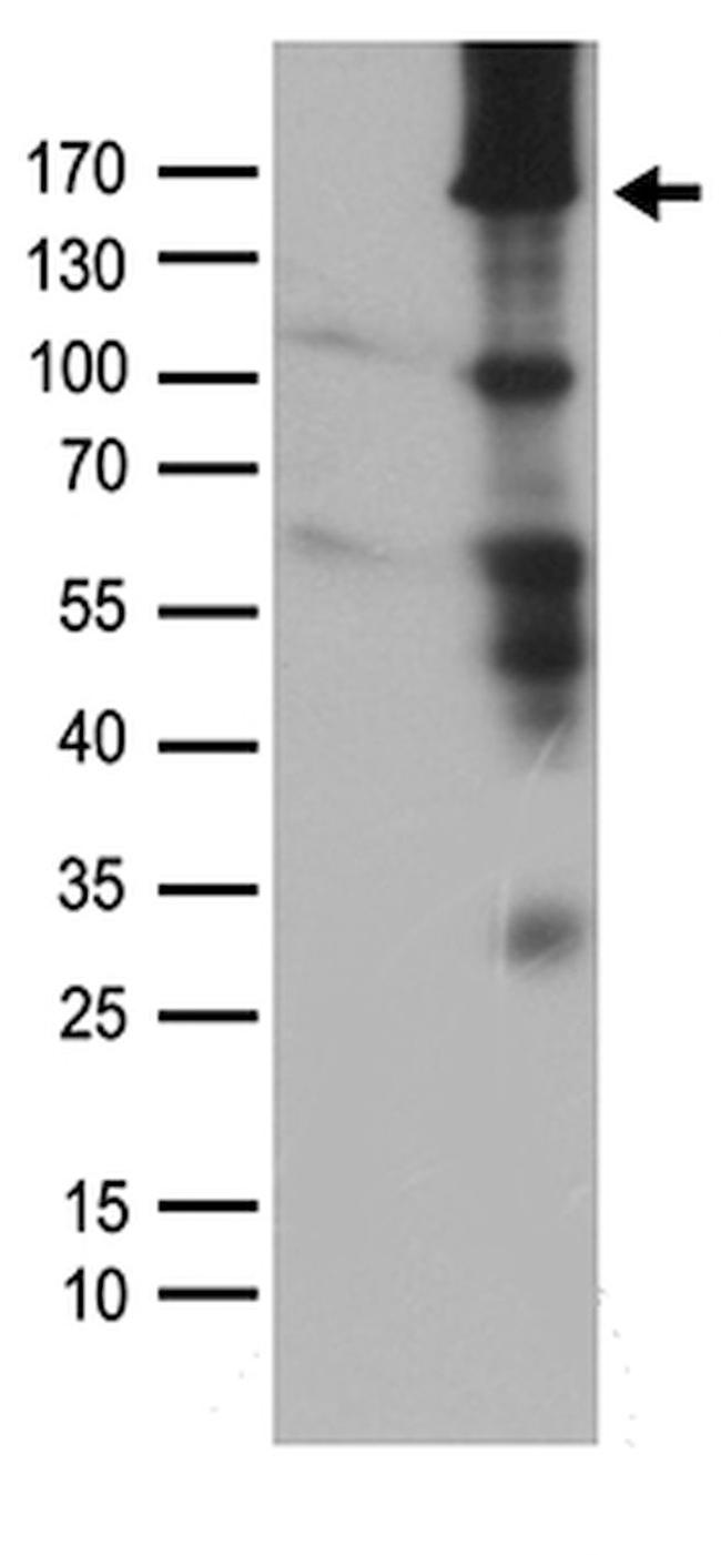 MAP3K5 Antibody in Western Blot (WB)