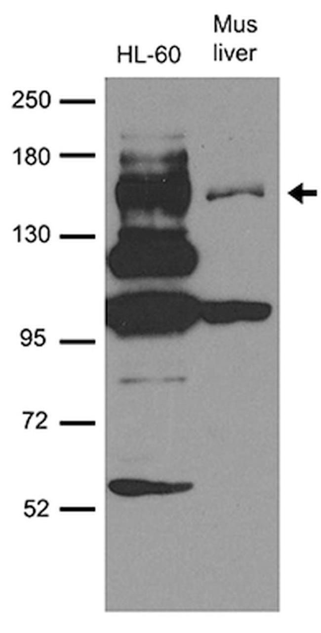 MAP3K5 Antibody in Western Blot (WB)