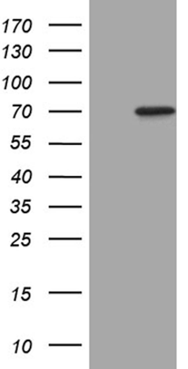 MAP3K7 Antibody in Western Blot (WB)