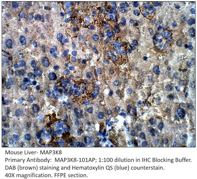 MAP3K8 Antibody in Immunohistochemistry (IHC)