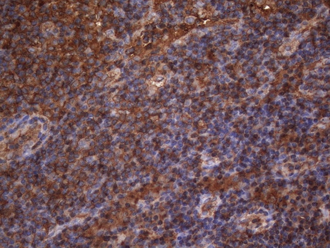 MAP3K8 Antibody in Immunohistochemistry (Paraffin) (IHC (P))