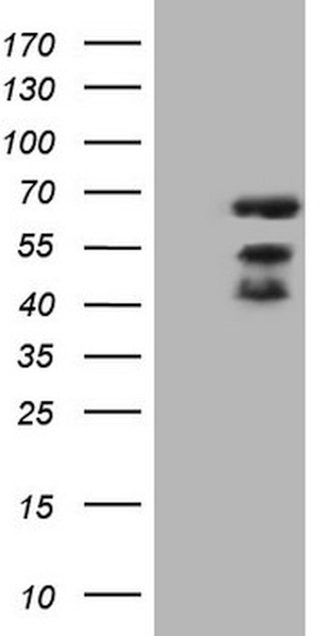 MAP3K8 Antibody in Western Blot (WB)