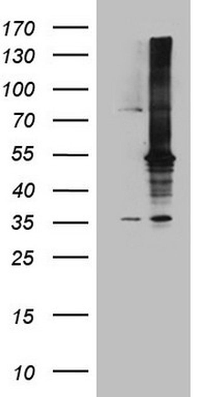MAP3K8 Antibody in Western Blot (WB)