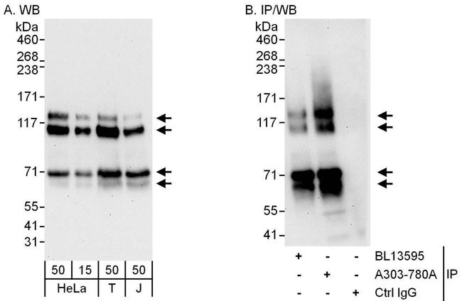 MAP7D1 Antibody in Western Blot (WB)