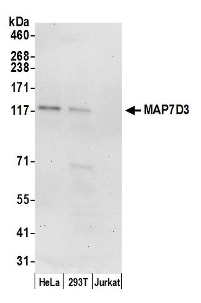 MAP7D3 Antibody in Western Blot (WB)