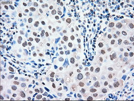 MAPK1 Antibody in Immunohistochemistry (Paraffin) (IHC (P))