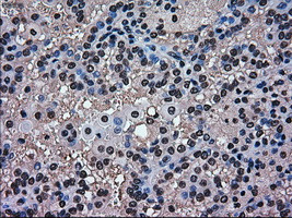 MAPK1 Antibody in Immunohistochemistry (Paraffin) (IHC (P))